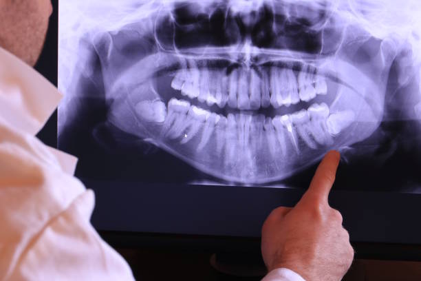 Best Emergency Dental Care for Broken or Chipped Teeth in Coon Rapids, IA