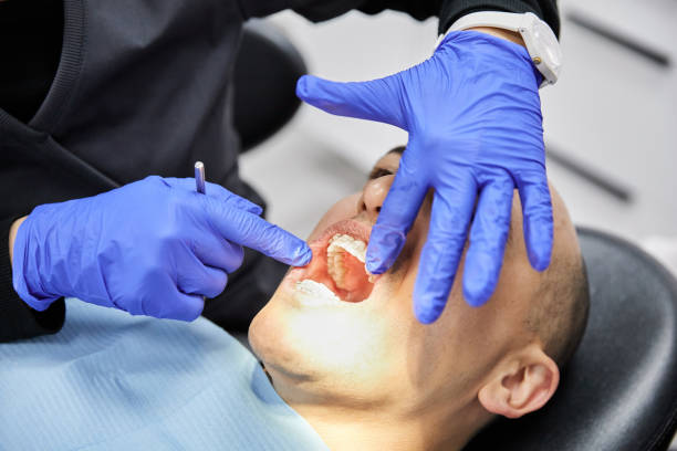 Best Emergency Wisdom Teeth Removal in Coon Rapids, IA